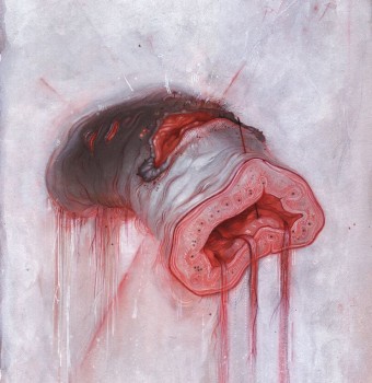 American Heritage – Prolapse